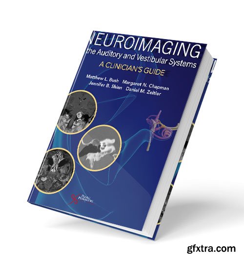 Neuroimaging of the Auditory and Vestibular Systems: A Clinician’s Guide