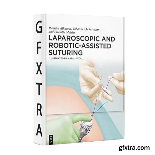 Laparoscopic and Robotic-Assisted Suturing
