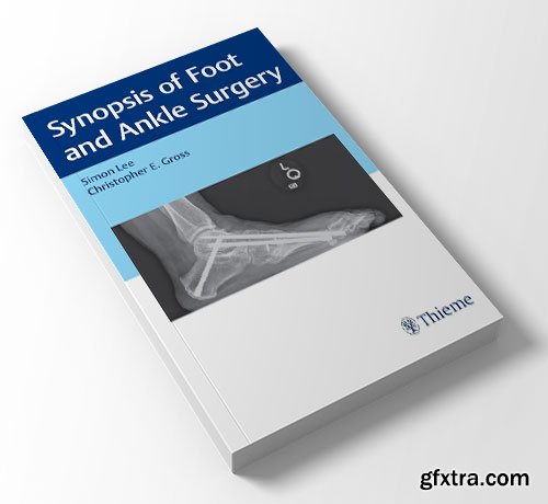 Synopsis of Foot and Ankle Surgery