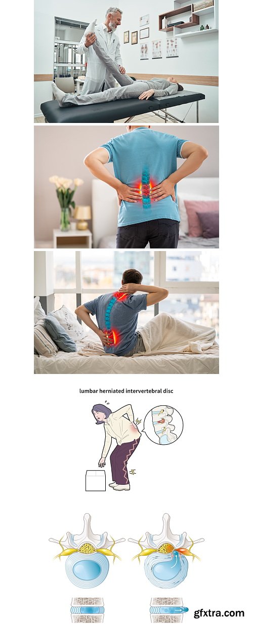 Herniated Disc Set 37xJPG, 10xAI &amp; 1xINDT