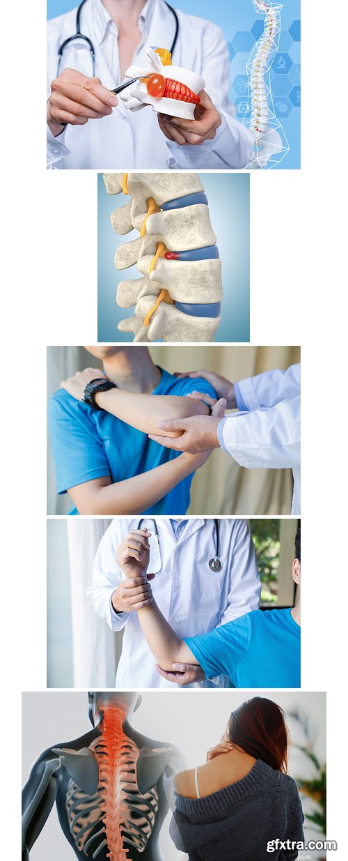 Herniated Disc Set 37xJPG, 10xAI &amp; 1xINDT