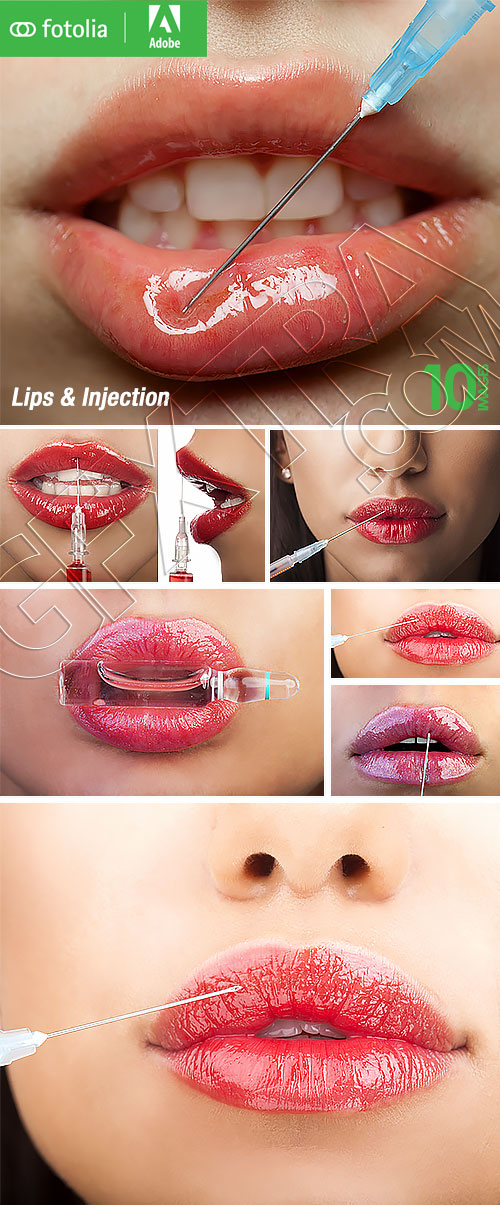 Lips And Injection 10xJPG Lips And Injection 10xJPG