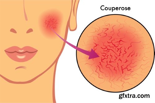 Medical Vectors #12, 25xEPS