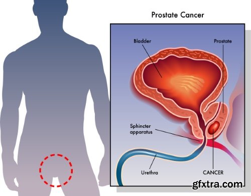 Medical Vectors #12, 25xEPS