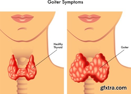 Medical Vectors #12, 25xEPS
