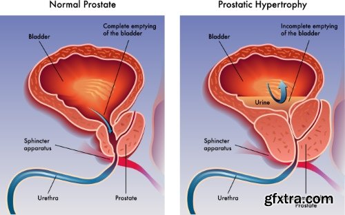 Medical Vectors #12, 25xEPS