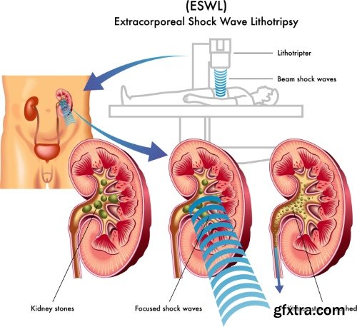 Medical Vectors #12, 25xEPS