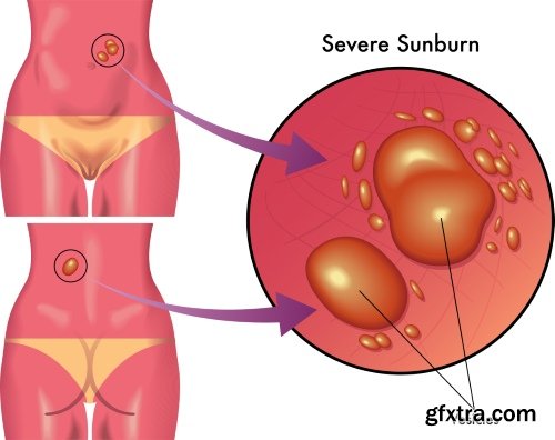 Medical Illustrations #2, 25xEPS