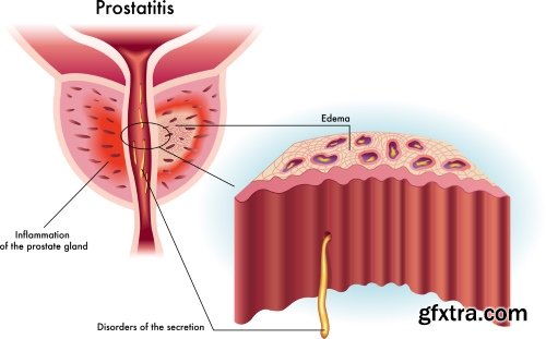 Medical Illustrations #2, 25xEPS