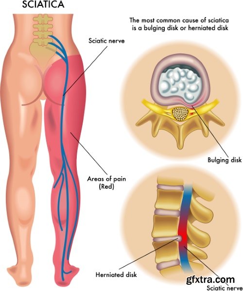 Medical Vectors #1, 25xEPS