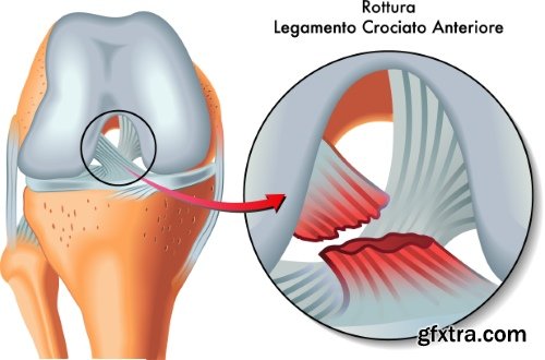 Medical Vectors #1, 25xEPS