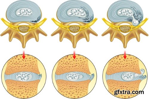 Medical Vectors #1, 25xEPS