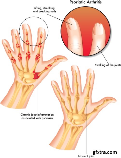 Medical Vectors #1, 25xEPS