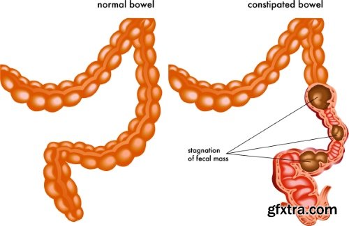 Medical Vectors #6, 25xEPS