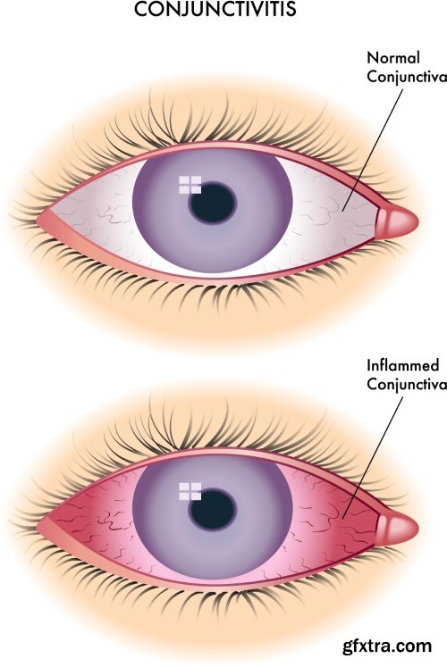 Medical Vectors #6, 25xEPS