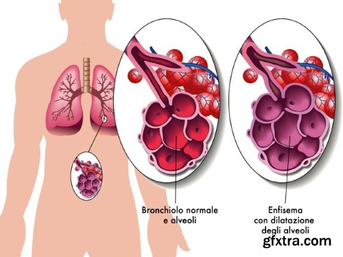 Medical Vectors #6, 25xEPS