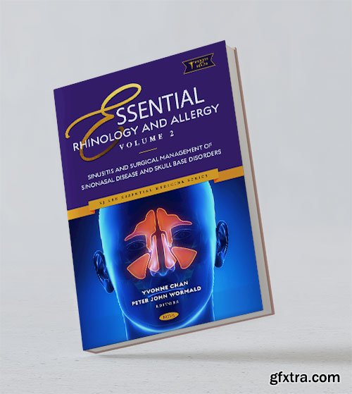 Essential Rhinology and Allergy. Volume 2: Sinusitis and Surgical Management of Sinonasal Disease and Skull Base Disorders
