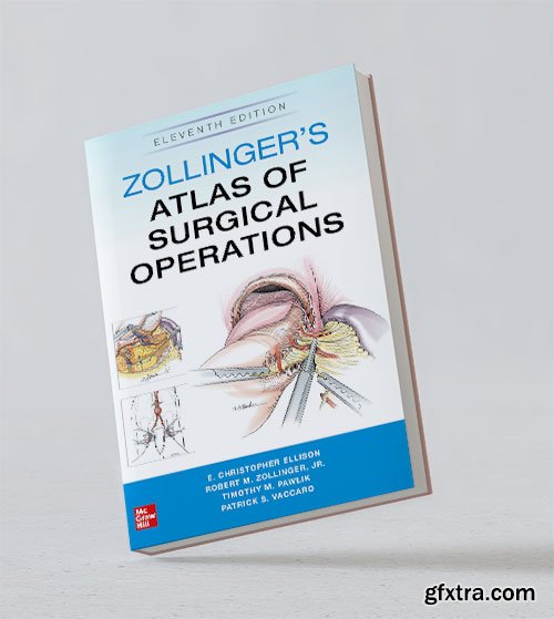 Zollinger\'s Atlas of Surgical Operations, 11th Edition