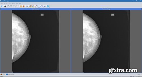 Sante FFT Imaging 1.4.4
