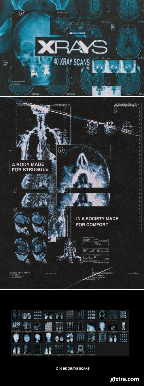 CreativeMarket - X-Rays Image Pack 12698205