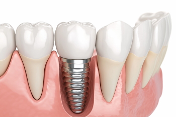 Dentistry and Dental Treatment Technology 35xPNG Dentistry and Dental Treatment Technology 35xPNG